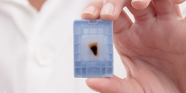 Fewer PCR Duplicates When Extracting DNA with the Ionic Purification System 
