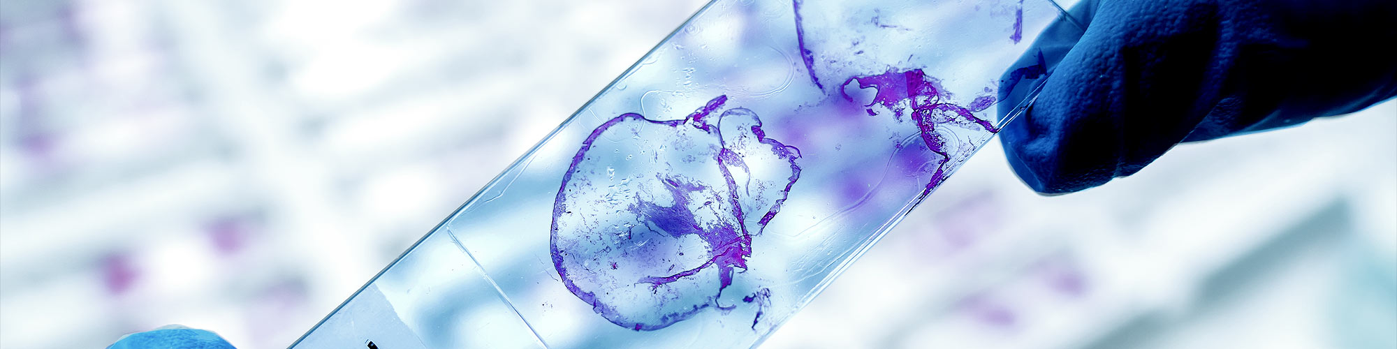 Macrodissection of FFPE Tissue for Nucleic Acid Purification